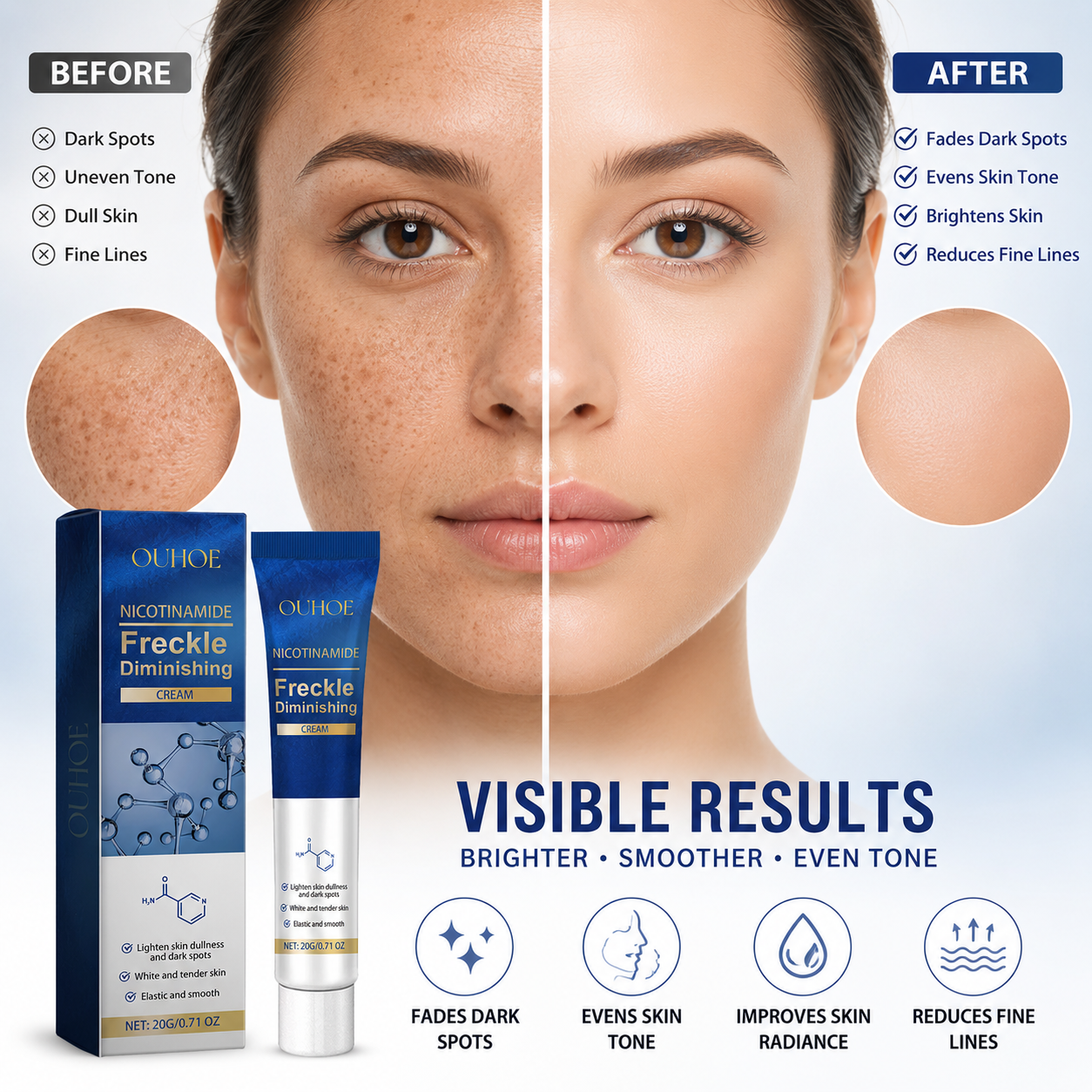 OUHOE Facial Dark Spot Cream: Fades dark spots, brightens skin tone, moisturizes and nourishes, hydrates and softens the skin-OKL