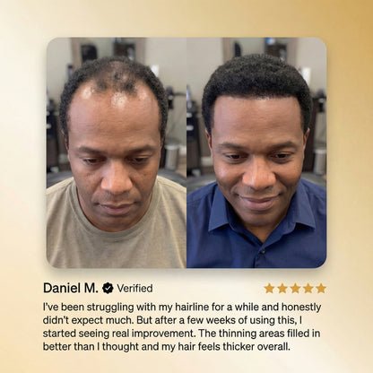 Advanced Batana Hair Regrowth Therapy-EDC - cartographermarket