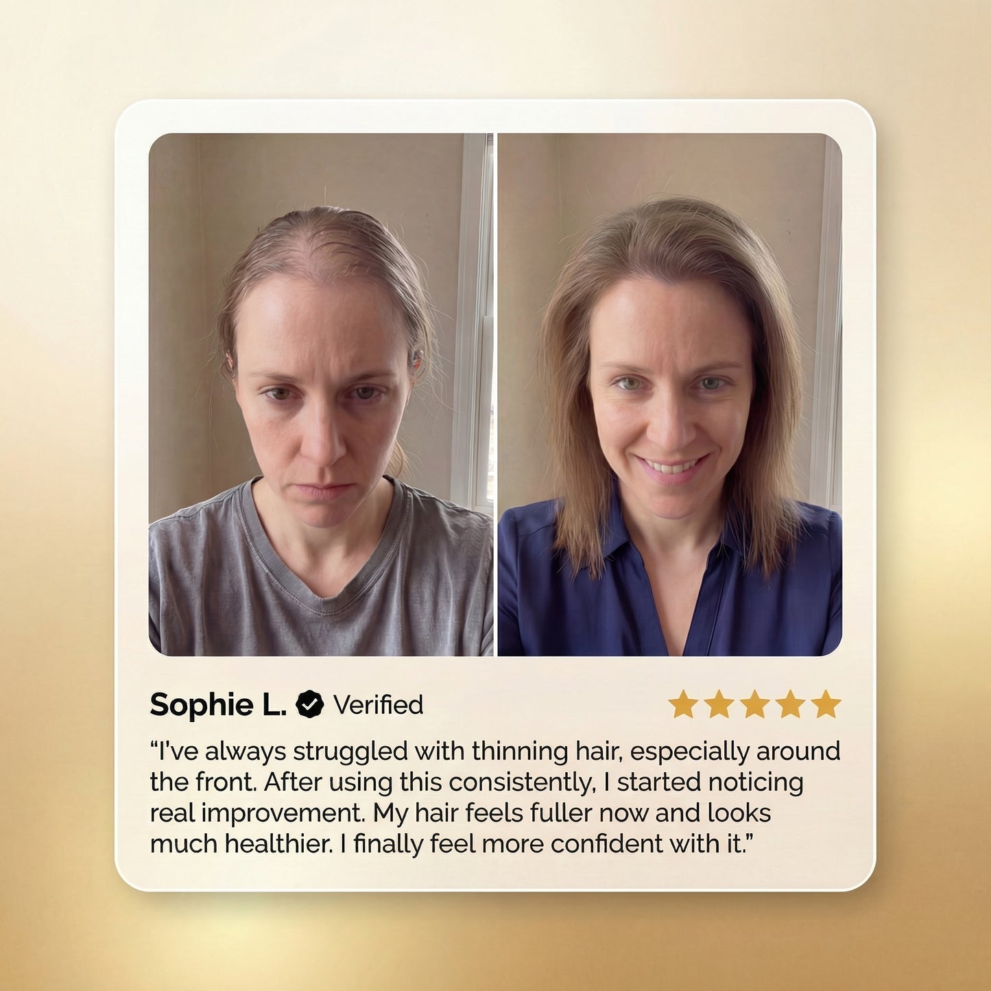 Advanced Batana Hair Regrowth Therapy-EDC - cartographermarket