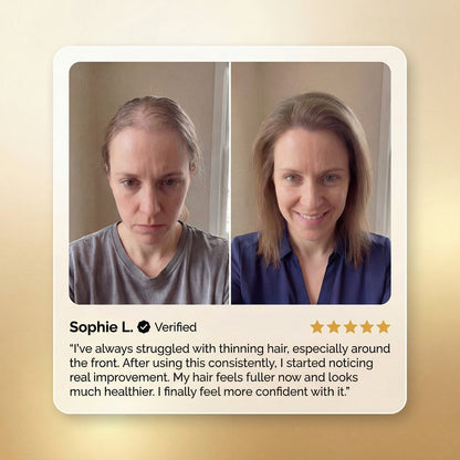 Advanced Batana Hair Regrowth Therapy-EDC - cartographermarket