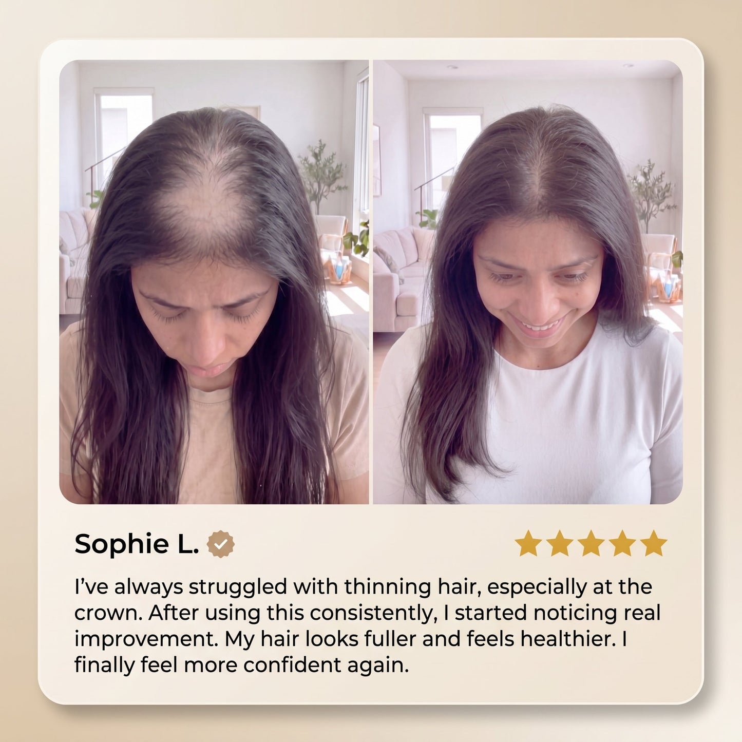 Advanced Batana Hair Regrowth Therapy-EDC - cartographermarket