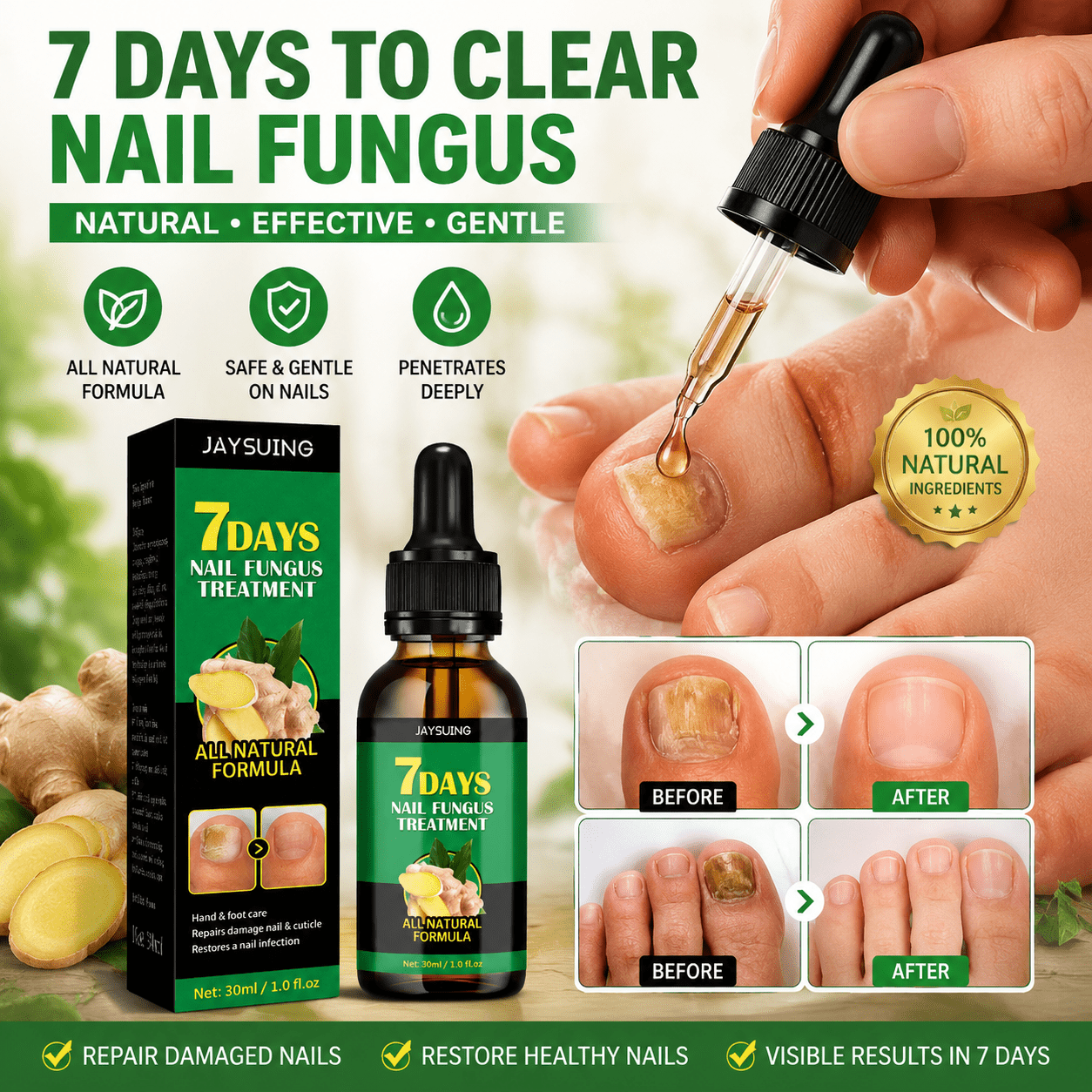 ✨ Clear Your Nail Fungus in Just 7 Days! ✨-EDC - cartographermarket