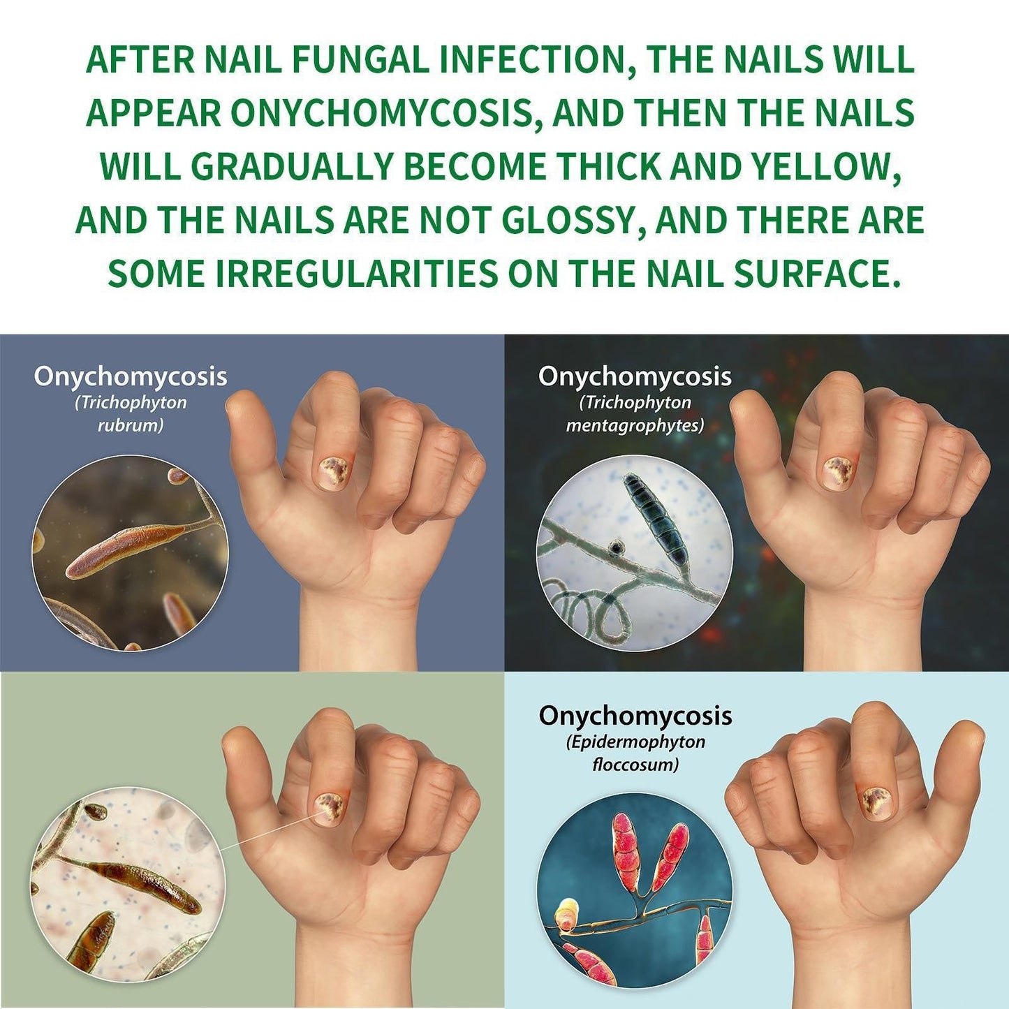 ✨ Clear Your Nail Fungus in Just 7 Days! ✨-EDC - cartographermarket