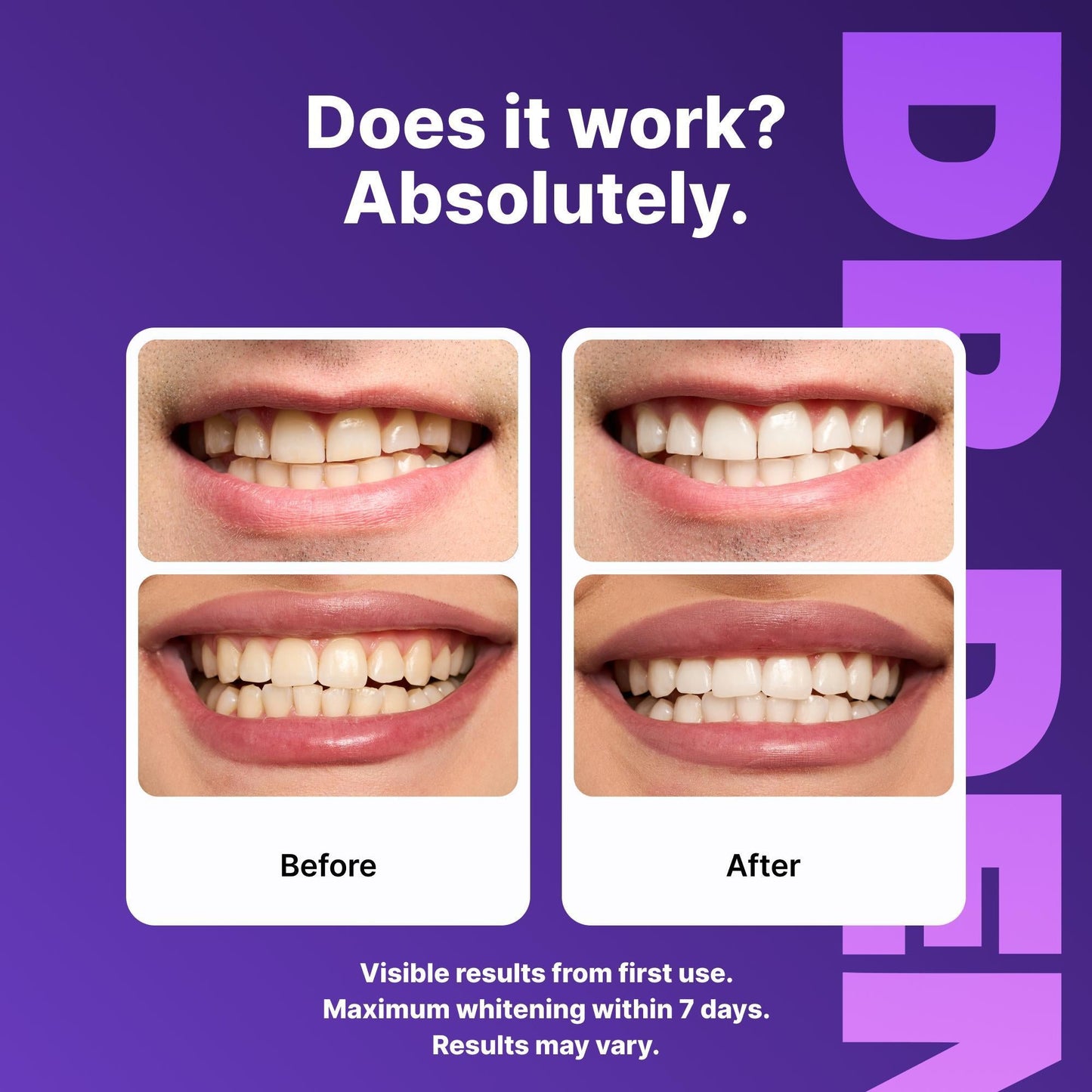 DRDENT Purple Teeth Whitening Strips - 7/21 Whitening Sessions - Safe for Enamel - Non Sensitive Teeth Whitening - Peroxide - Free - LGZ - cartographermarket
