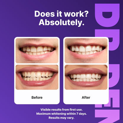 DRDENT Purple Teeth Whitening Strips - 7/21 Whitening Sessions - Safe for Enamel - Non Sensitive Teeth Whitening - Peroxide - Free - LGZ - cartographermarket