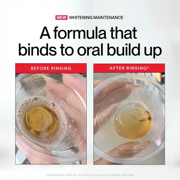 Hismile iD Stain Whitening Mouthwash for White Teeth, Freshens Breath with Essential Oils - OKN - cartographermarket