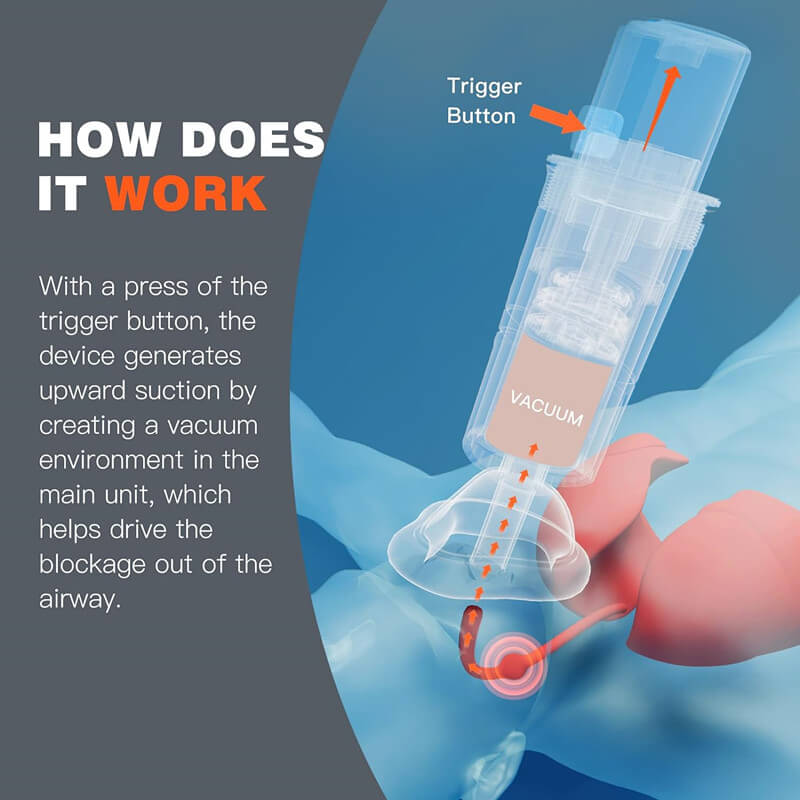 🛡️ Life - Saving Protection: Automatic Choking Rescue Device 🛡️ - EDC - cartographermarket