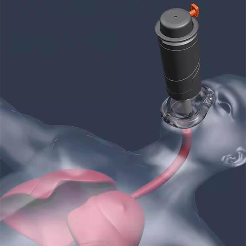 🛡️ Life - Saving Protection: Automatic Choking Rescue Device 🛡️ - EDC - cartographermarket