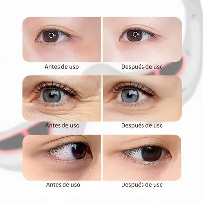 🌟 Revitalize Your Eyes: The Ultimate Red Light Therapy Solution 🌟 - EDC - cartographermarket