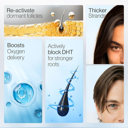 💆 Suitable for men & women, strengthens hair roots, reduces hair loss-VIM - cartographermarket