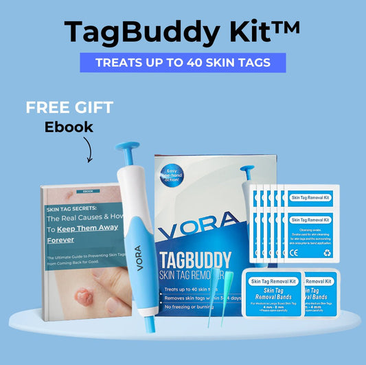 TagBuddy Kit – No More Skin Tags - EDC - cartographermarket